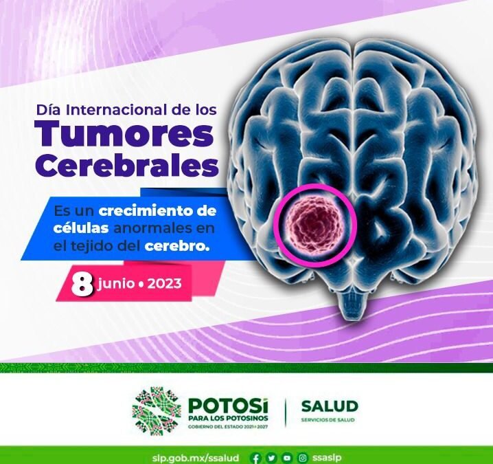 MUCHOS DE LOS TUMORES CEREBRALES SON TRATABLES Y CURABLES SI SE DETECTAN A TIEMPO.