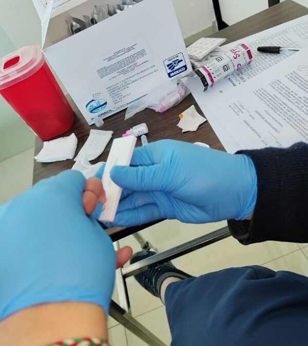 PRUEBAS DIAGNÓSTICAS DE VIH SON GRATUITAS EN LOS SERVICIOS DE SALUD