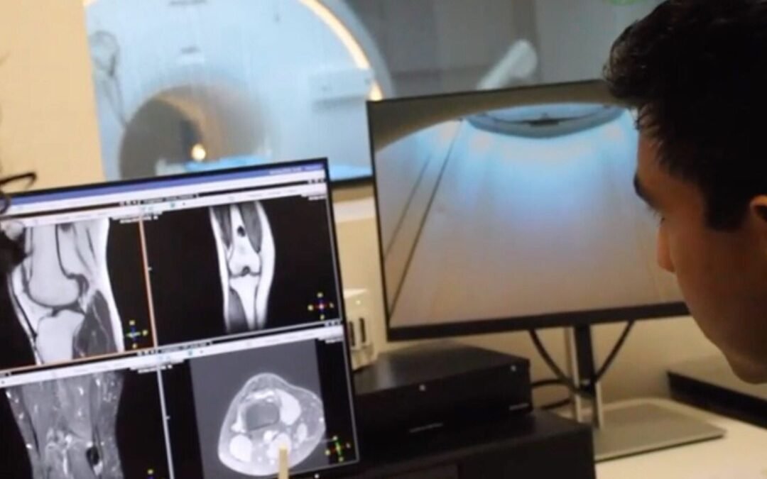 HOSPITAL CENTRAL «DR. IGNACIO MORONES PRIETO» SE UNE A LA CONMEMORACIÓN DEL DÍA INTERNACIONAL DE LA CEFALEA EN RACIMO