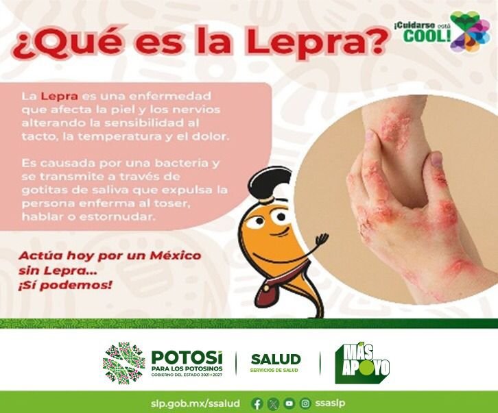 CONTINÚA SALUD CON ACCIONES DE PREVENCIÓN Y ATENCIÓN CONTRA LA LEPRA EN SLP