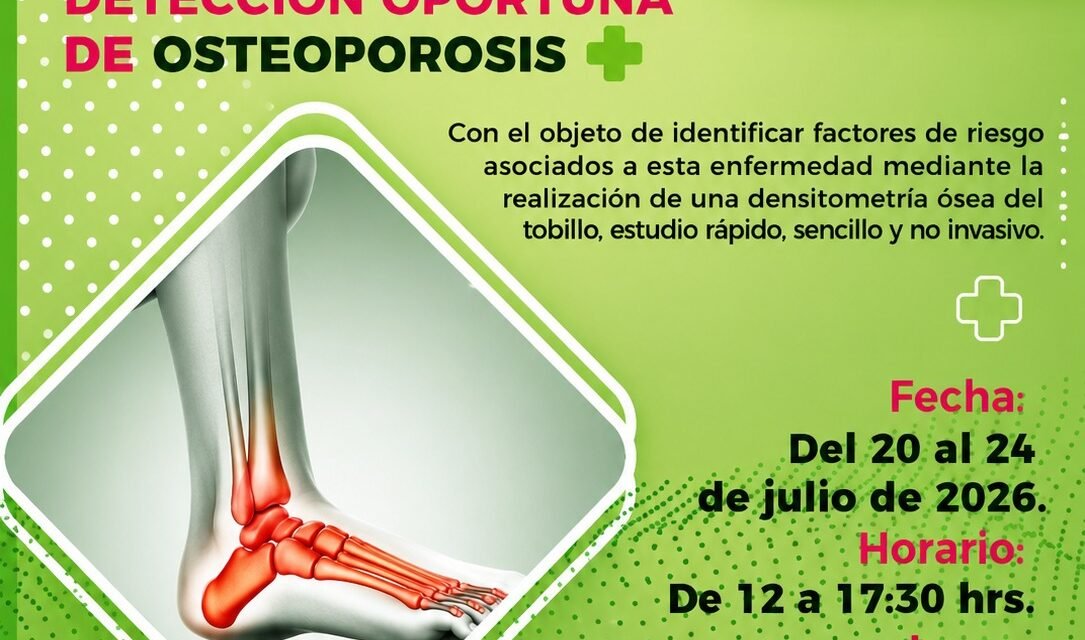 OFICIALÍA MAYOR OFRECERÁ DETECCIÓN GRATUITA DE OSTEOPOROSIS
